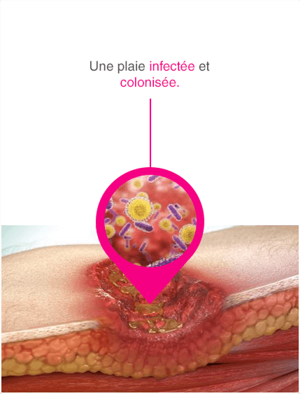 CH_FR_wounds_zoom_01