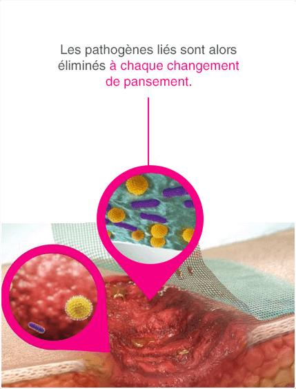 CH_FR_wounds_zoom_03