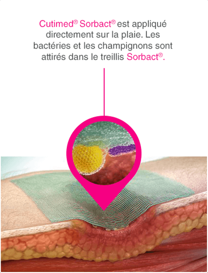 CH_FR_wounds_zoom_02
