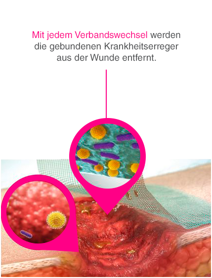 CH_DE_wounds_zoom_03